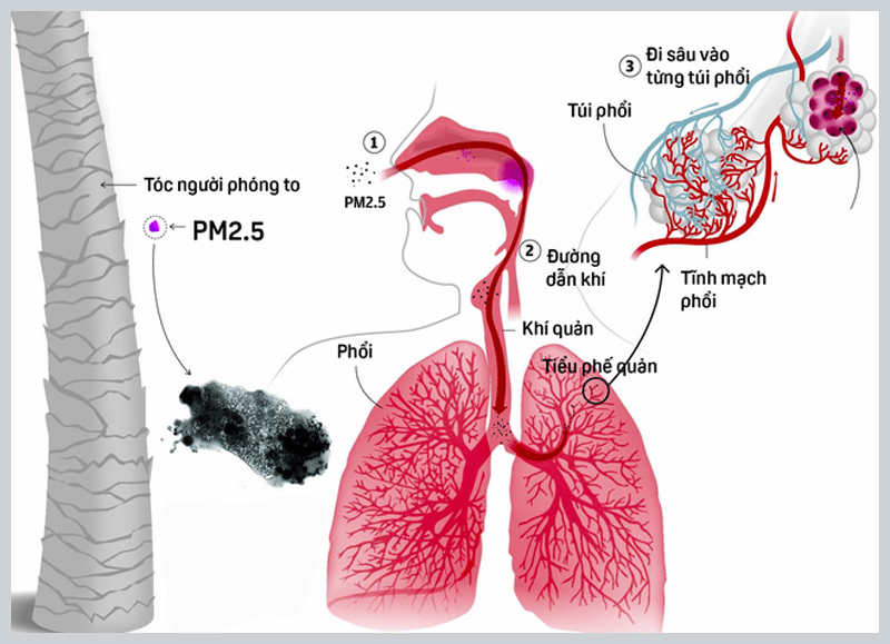 Cơ chế xâm nhập của bụi PM2.5